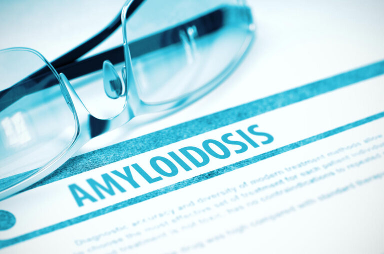 Is Amyloidosis a Myeloma?