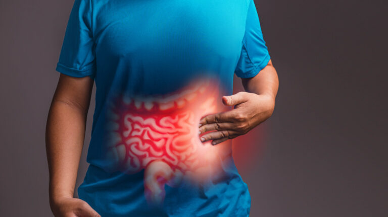 What is the Leading Cause of Ulcerative Colitis?